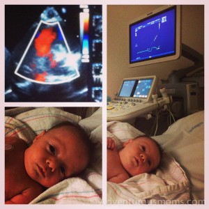 Evan's echocardiogram