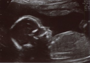 Baby Bauer Ultrasound!